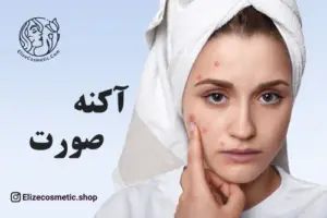 الیزه کازمتیک Elizecosmetic face acne آکنه صورت و بدن آکنه چیست؟ درمان آکنه